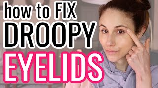 How to FIX DROOPY HOODED EYELIDS Dr Dray [upl. by Elok520]