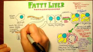 Fatty Liver Pathophysiology [upl. by Waters]