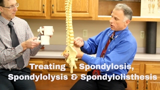 Treating Spondylosis Spondylolysis amp Spondylolisthesis Lumbar Spine [upl. by Eiser401]