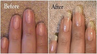 Going From Short Nails To Long Natural Nails 3 Month Nail Growth [upl. by Werdnael]