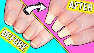 How to GROW YOUR NAILS FAST actually helpful information [upl. by Nnylyt]