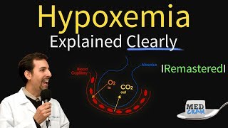 Hypoxemia  The 5 Causes amp Treatment 1 High Altitude [upl. by Otrebide963]