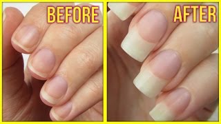 5 Ways to Grow Your Nails FAST [upl. by Ilyse]