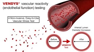 VENDYS  Endothelial Function Measurement Explained [upl. by Hakkeber]