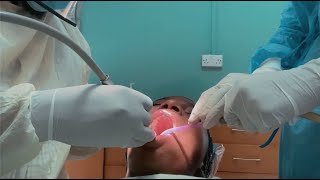 I had Dental surgery  My Cavity filling procedure [upl. by Mehta]