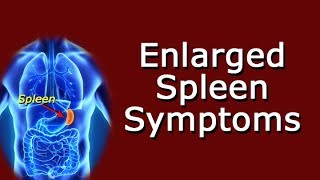 Enlarged Spleen Symptoms [upl. by Nabala]