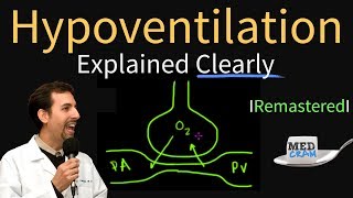 Hypoventilation and Hypoxemia Explained Clearly  Remastered [upl. by Alvan]