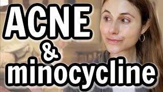 Minocycline versus doxycycline for acne Dr Dray [upl. by Olivia332]