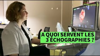 Les bases physique de léchographie [upl. by Weiss395]