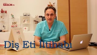 Diş Eti İltihabı  Prof Dr Bülent Kurtiş [upl. by Eicnarf]