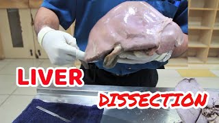 Anatomy Dissection of Liver [upl. by Naejeillib]