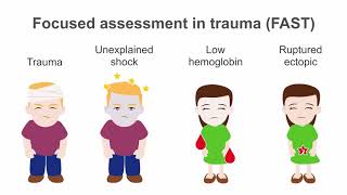 Understanding pointofcare ultrasound POCUS in trauma assessment [upl. by Jacintha]