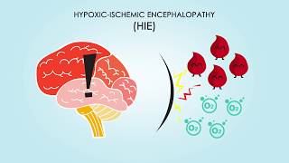 HypoxicIschemic Encephalopathy About Treatments amp Causes [upl. by Bevash68]