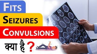 Fits Seizures and Convulsions क्या है [upl. by Terchie]