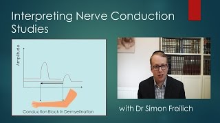 Interpreting Nerve Conduction Studies [upl. by Petrine]