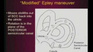 Epley Maneuver [upl. by Adair792]