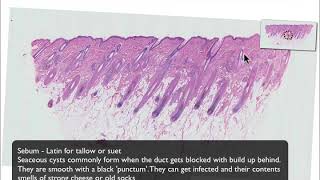 What your skin looks like down the microscope [upl. by Aihsenal664]