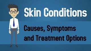 Skin Conditions  Causes Symptoms and Treatment Options [upl. by Ebert]