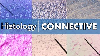 Histology  Connective Tissue [upl. by Everick739]