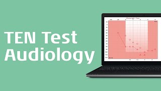 TEN Test Procedure [upl. by Watts313]