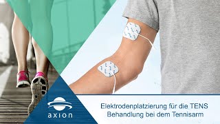 Tennisarm  Elektrodenplatzierung für TENS  axion [upl. by Suter]