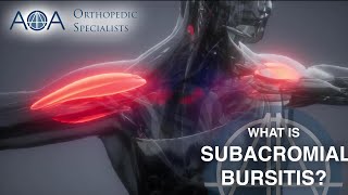 AOA Orthopedic Specialists  Subacromial Bursitis [upl. by Leoine796]