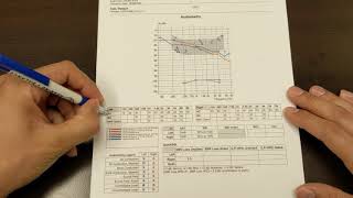 Hearing Test  Newborn Diagnostic Testing [upl. by Aicelef]